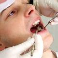 A foghúzás egyik lehetősége lehet a fogíny regenerálása
